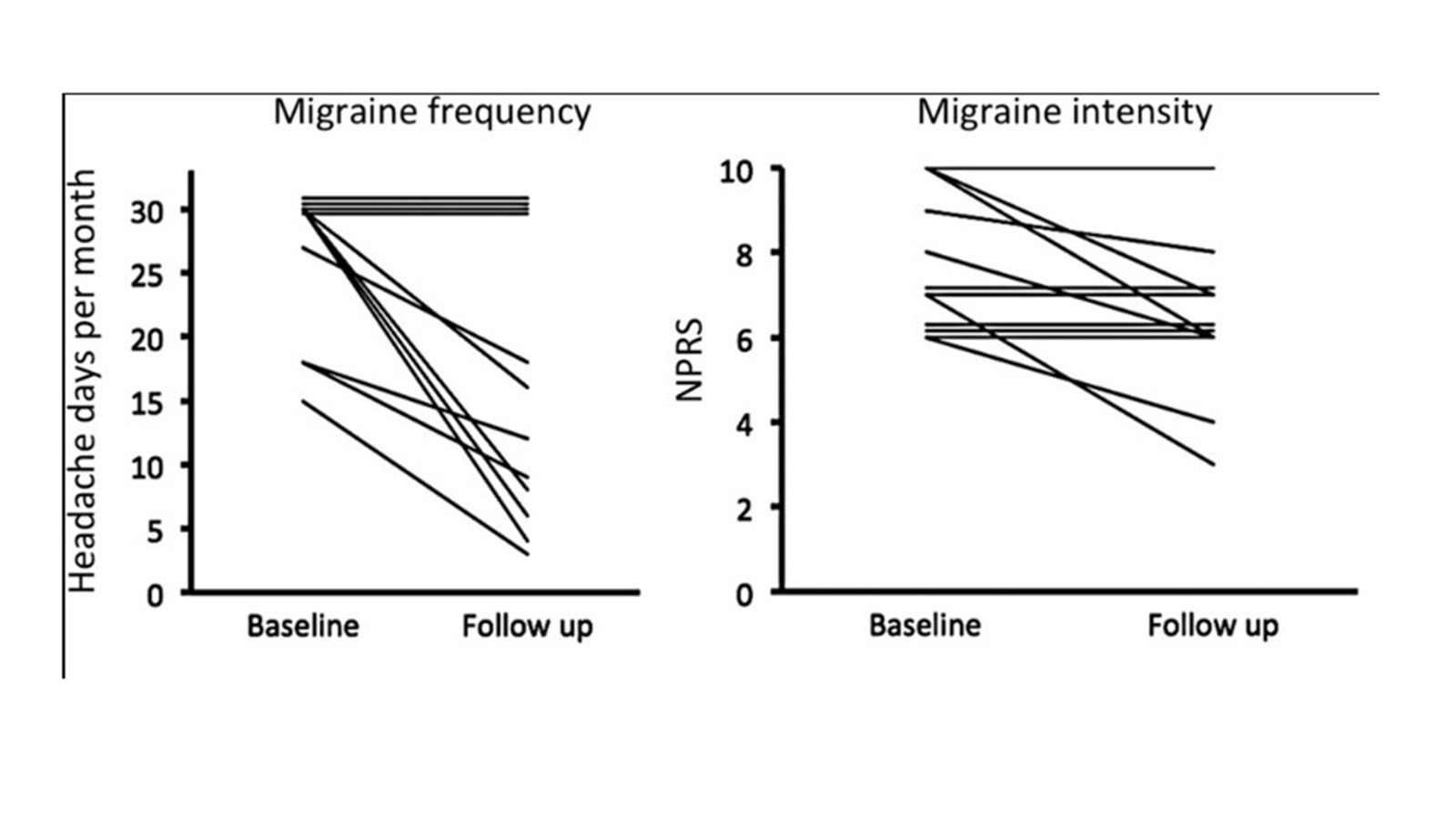 Représentation graphique des résultats de l'étude après Burst stimulation du nerf occipital chez des patients souffrant de migraine chronique