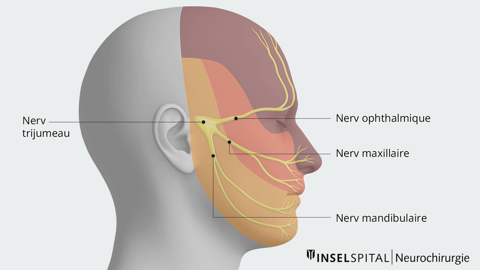 N vralgie Du Trijumeau Neurochirurgie Inselspital Bern N vralgie Du Trijumeau Neurochirurgie Inselspital Bern