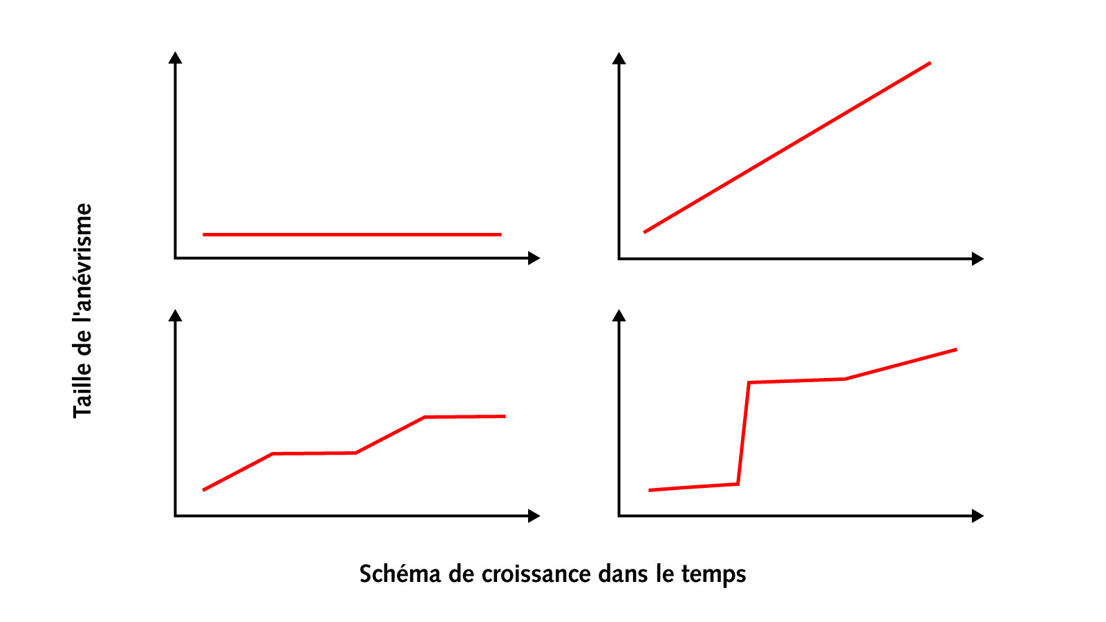 Courbes de croissance de différents anévrismes