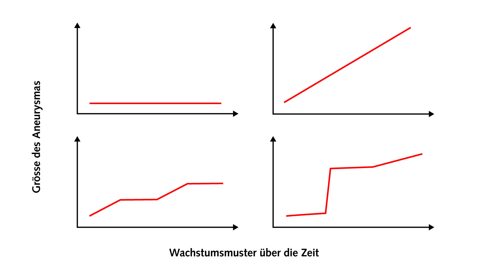 Wachstumskurven verschiedener Aneurysmen