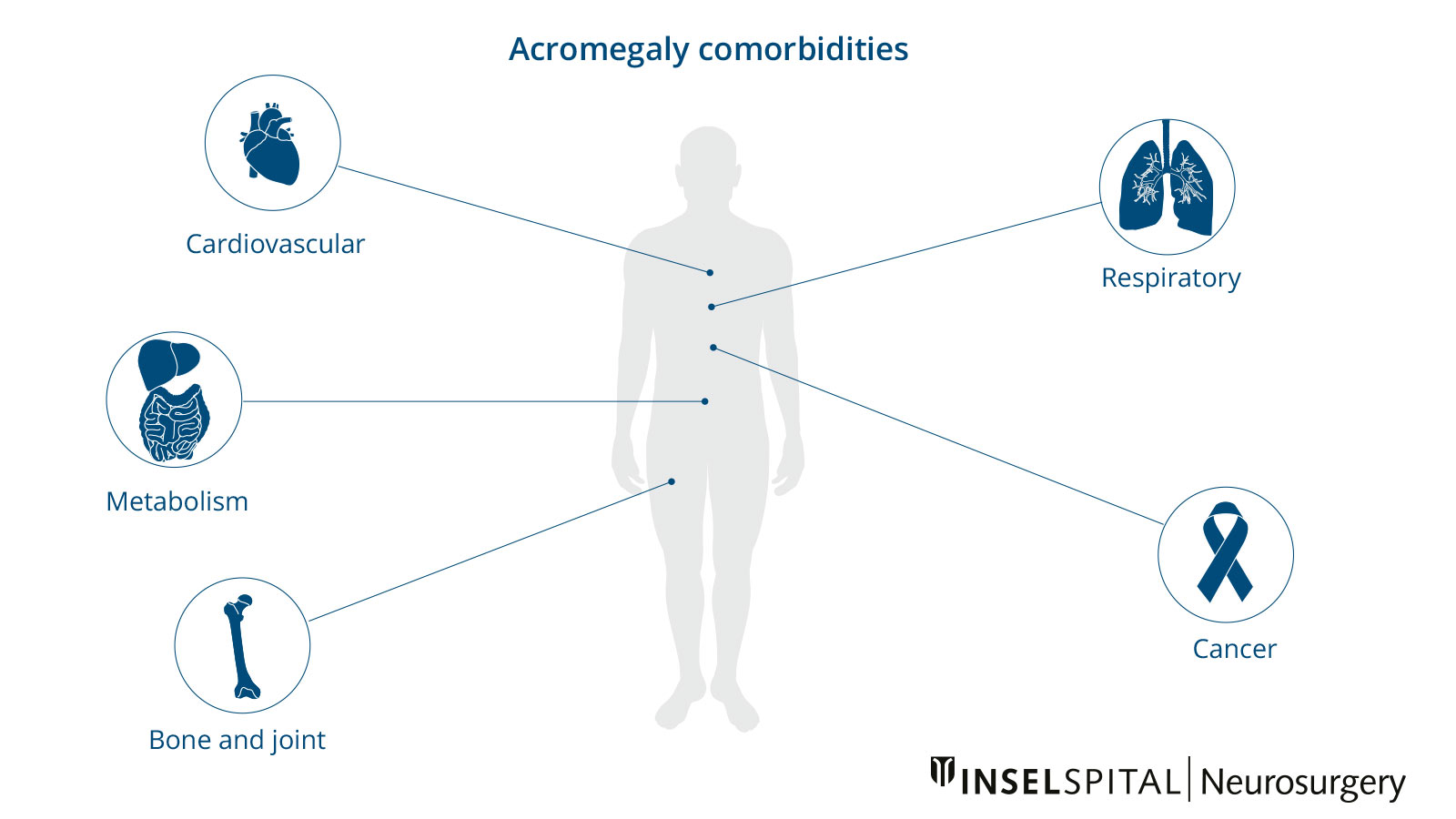 Infographic on comorbidities in acromegaly, illustrating the major organ systems affected.