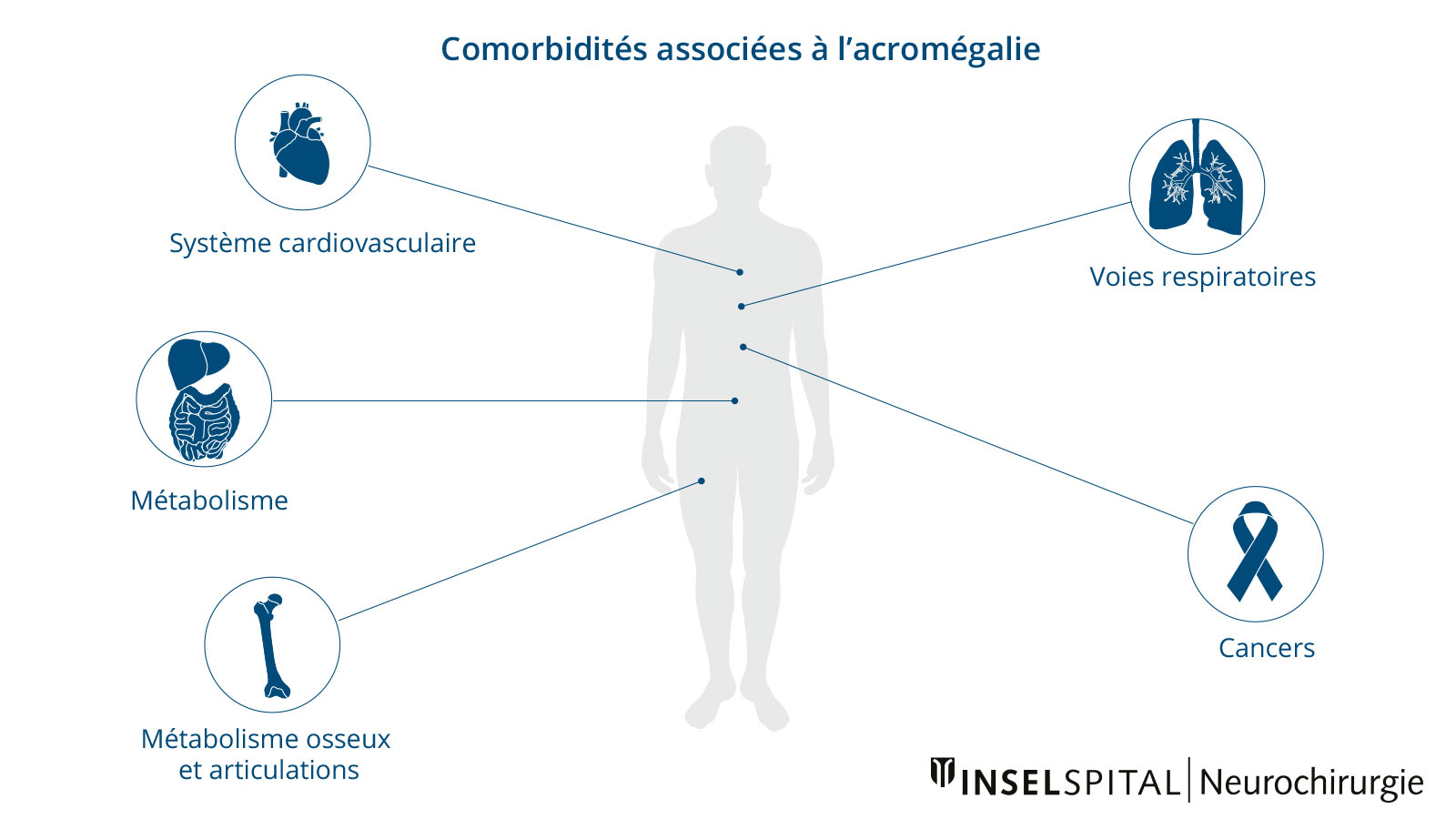 Infographie sur les comorbidités associées à l'acromégalie, présentant les principaux systèmes organiques touchés.