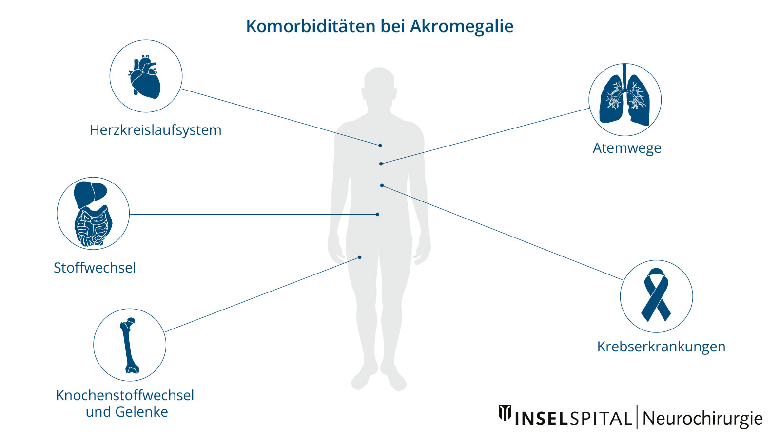 Infografik zu den Komorbiditäten bei Akromegalie mit Darstellung der wichtigsten betroffenen Organsysteme.